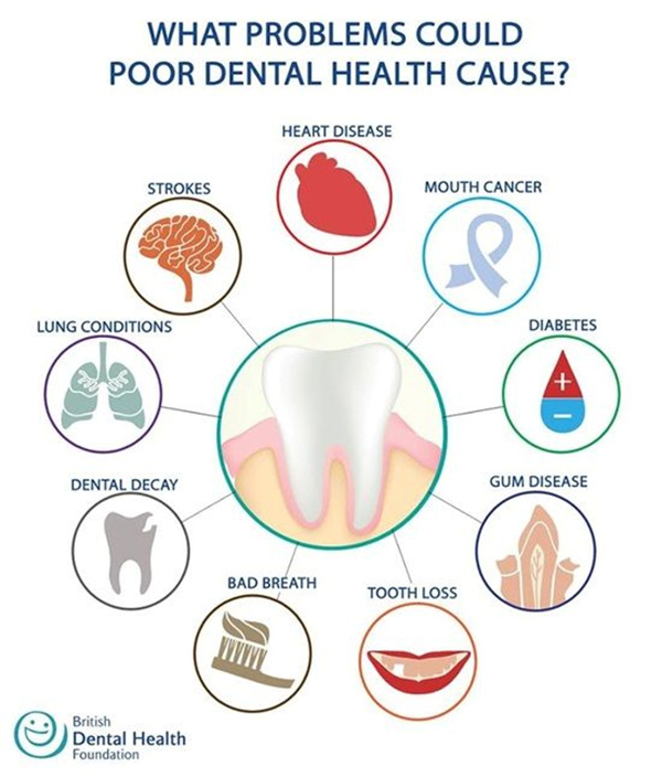 Oral health and its importance in sport - Clínica Pardiñas